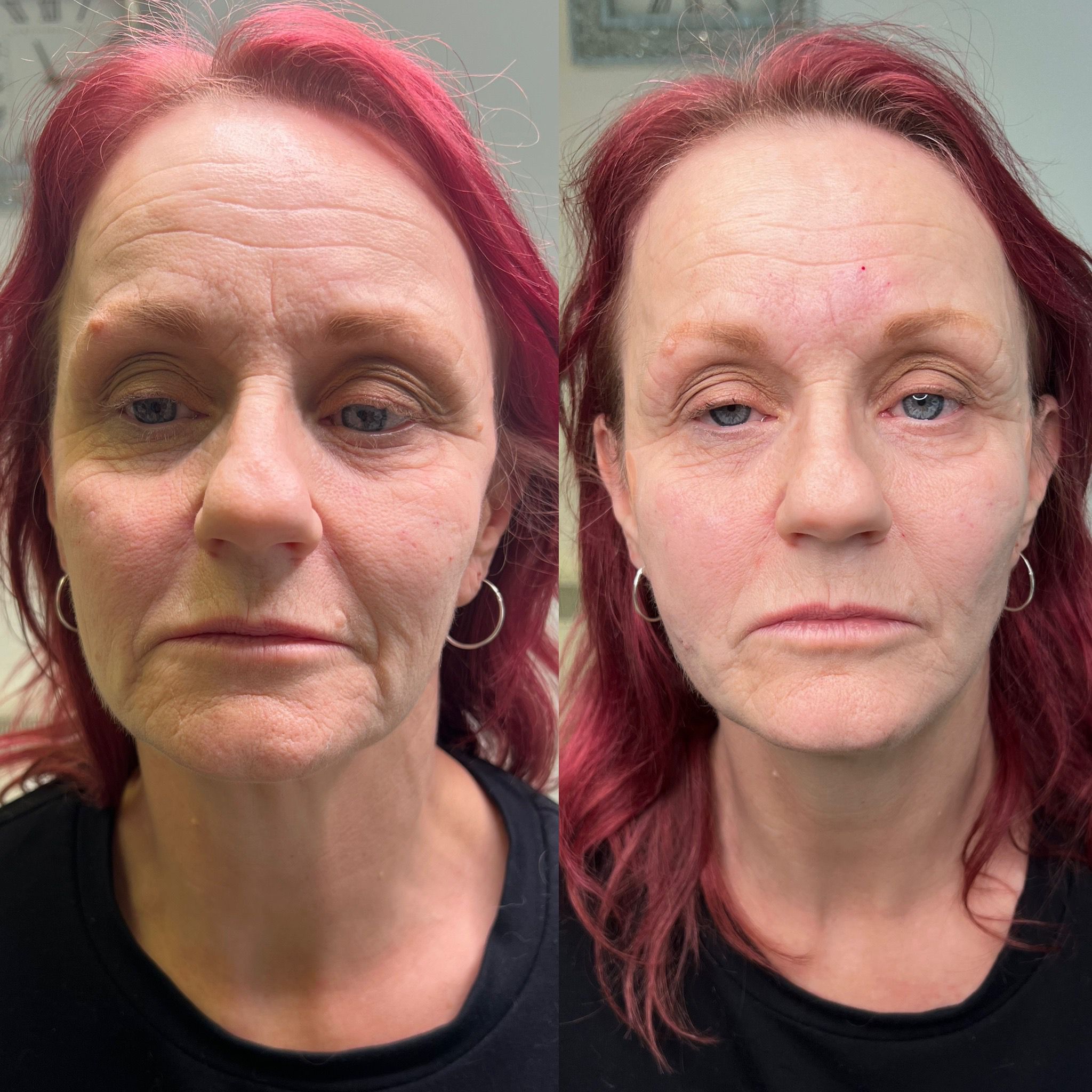 WhatsApp-Image-2024-07-22-at-6.16.50-PM