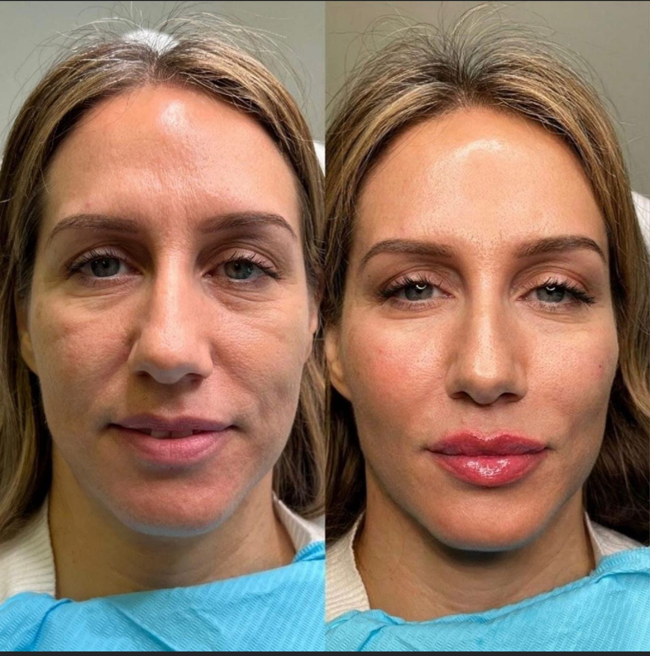 WhatsApp-Image-2024-07-22-at-6.16.58-PM