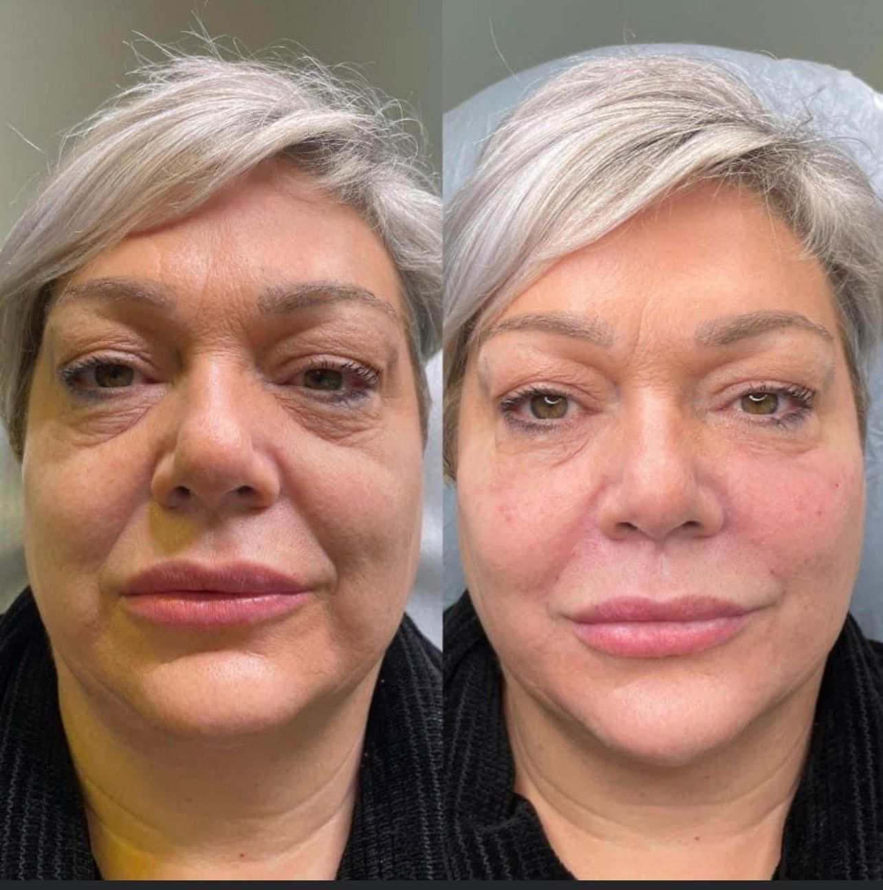 WhatsApp-Image-2024-07-22-at-6.16.59-PM